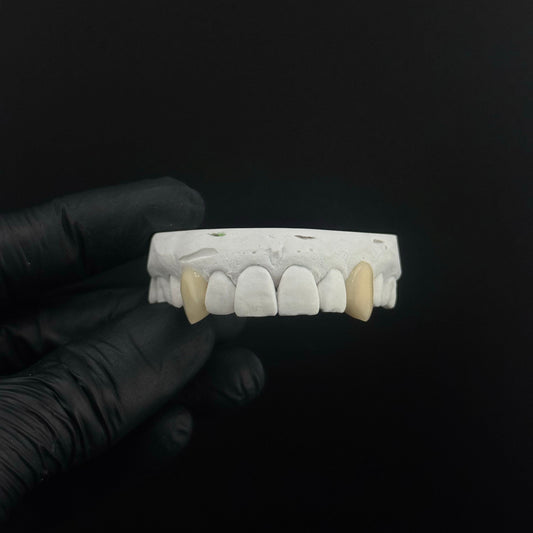 Colour Matched Fangs