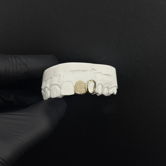 Diamond Dusted Cap (single tooth)