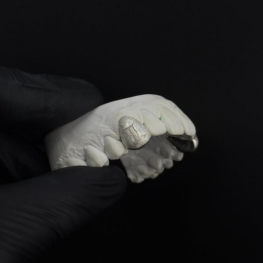 Diamond Dusted Engraved Letter Cap