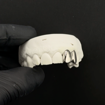 Missing Tooth (2 teeth minimum)