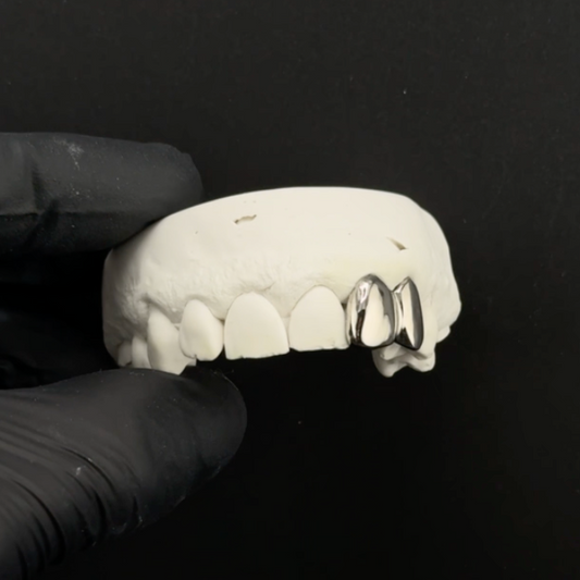 Missing Tooth (2 teeth minimum)