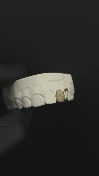 Diamond Dusted Cap (single tooth)